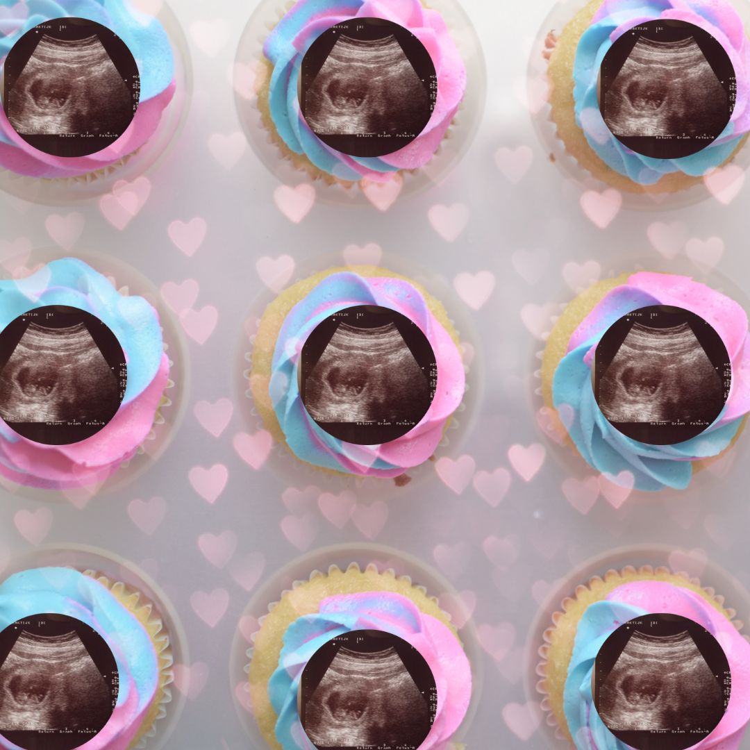 zwangerschap echo cupcakes